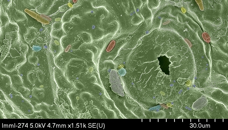 Competing microbes on grass. Taken using a Hitachi S-4700 FESEM scanning electron microscope by Alan Cookson at the IBERS Advanced Microscopy and Bio-Imaging Laboratory.