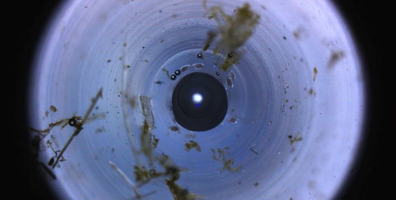 Nematode worm viewed eggs via FECPAK.