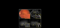 Automated detection of vascular structures within the retina.